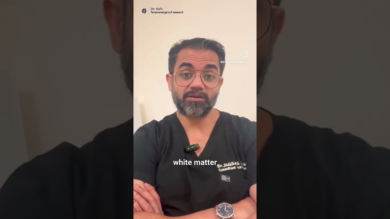 Neuronavigation: tech guides, skill decides. #Neurosurgery #brainsurgery