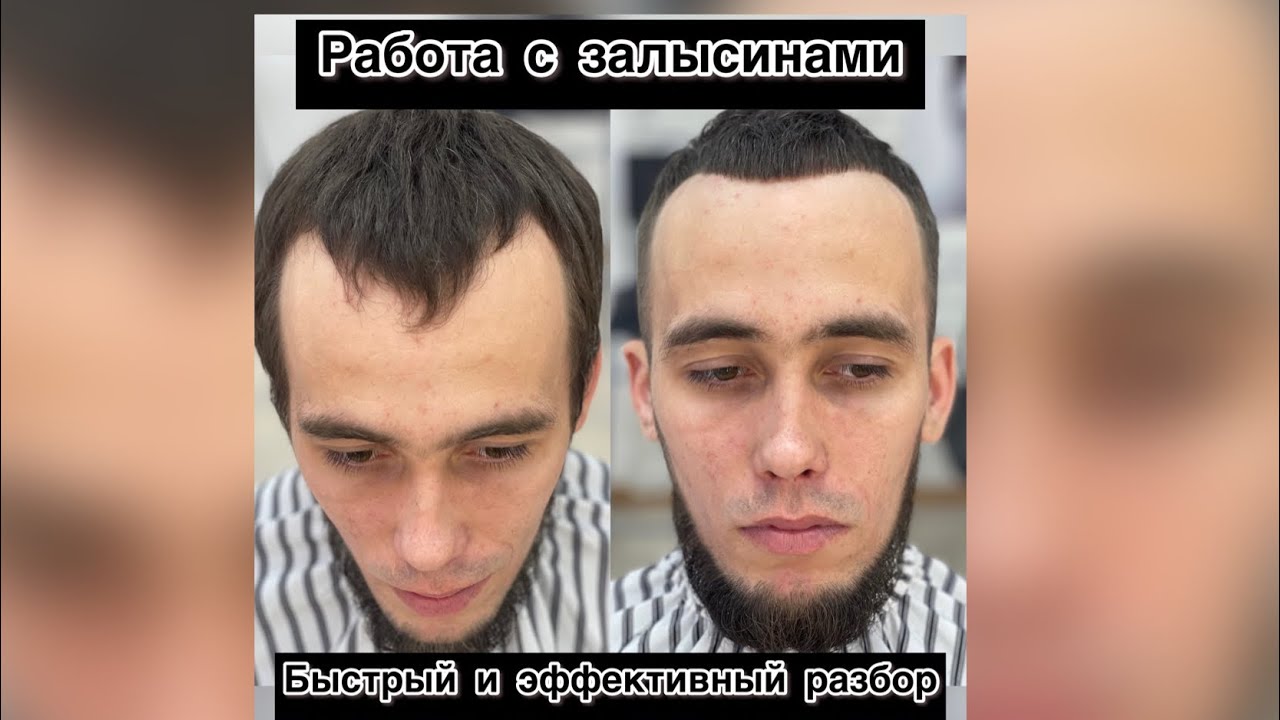 Мужская стрижка | Работа с залысинами | Краткий обзор |