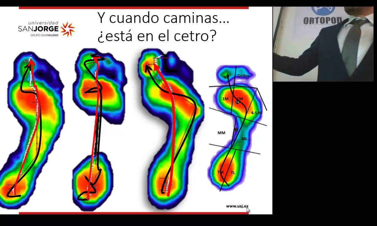 De la estática a la dinámica: Relaciones y abordajes. Congreso Podología México DF 2015
