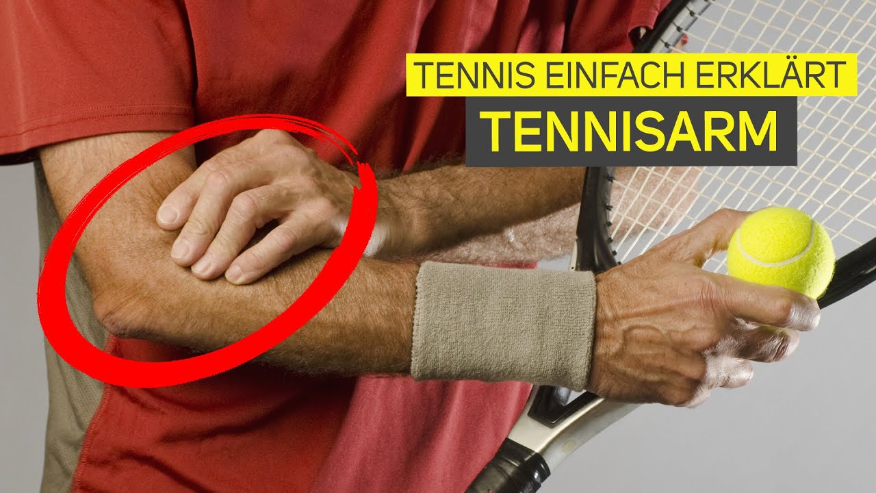 Was ist eigentlich ein Tennisarm? | Tennis einfach erklärt!