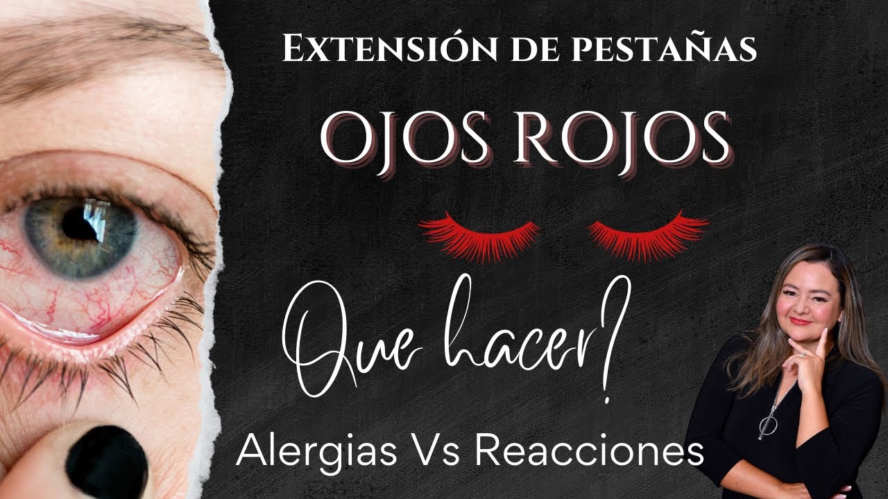 Ojos rojos por Extensión de pestañas. Que hacer y porque pasa. #adrianalashista