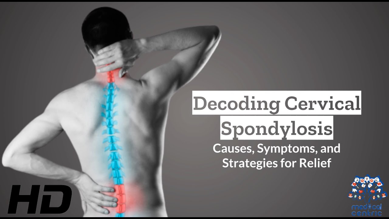 Cervical Spondylosis 101: Causes, Symptoms, and Treatment Insights