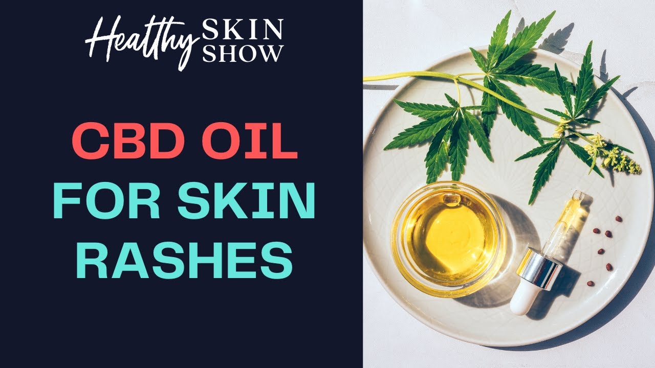 CBD Oil For Your Skin - Yea Or Nay? | Pamela Orth