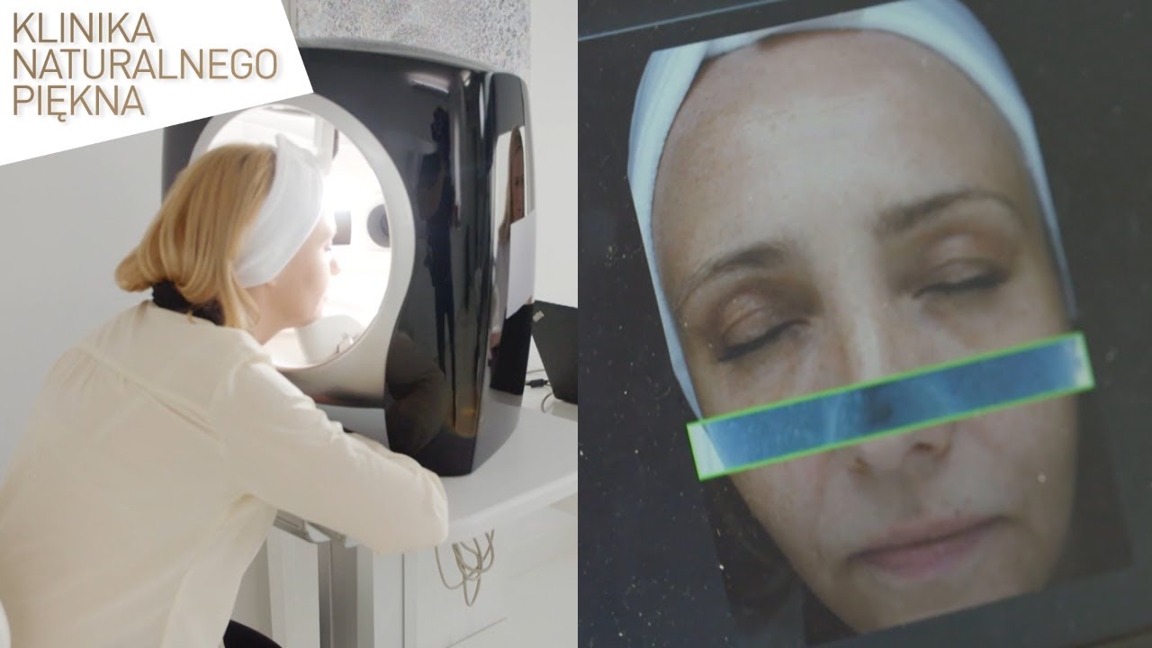 Jak działa urządzenie do analizy stanu sk&oacute;ry? [Klinika naturalnego piękna]