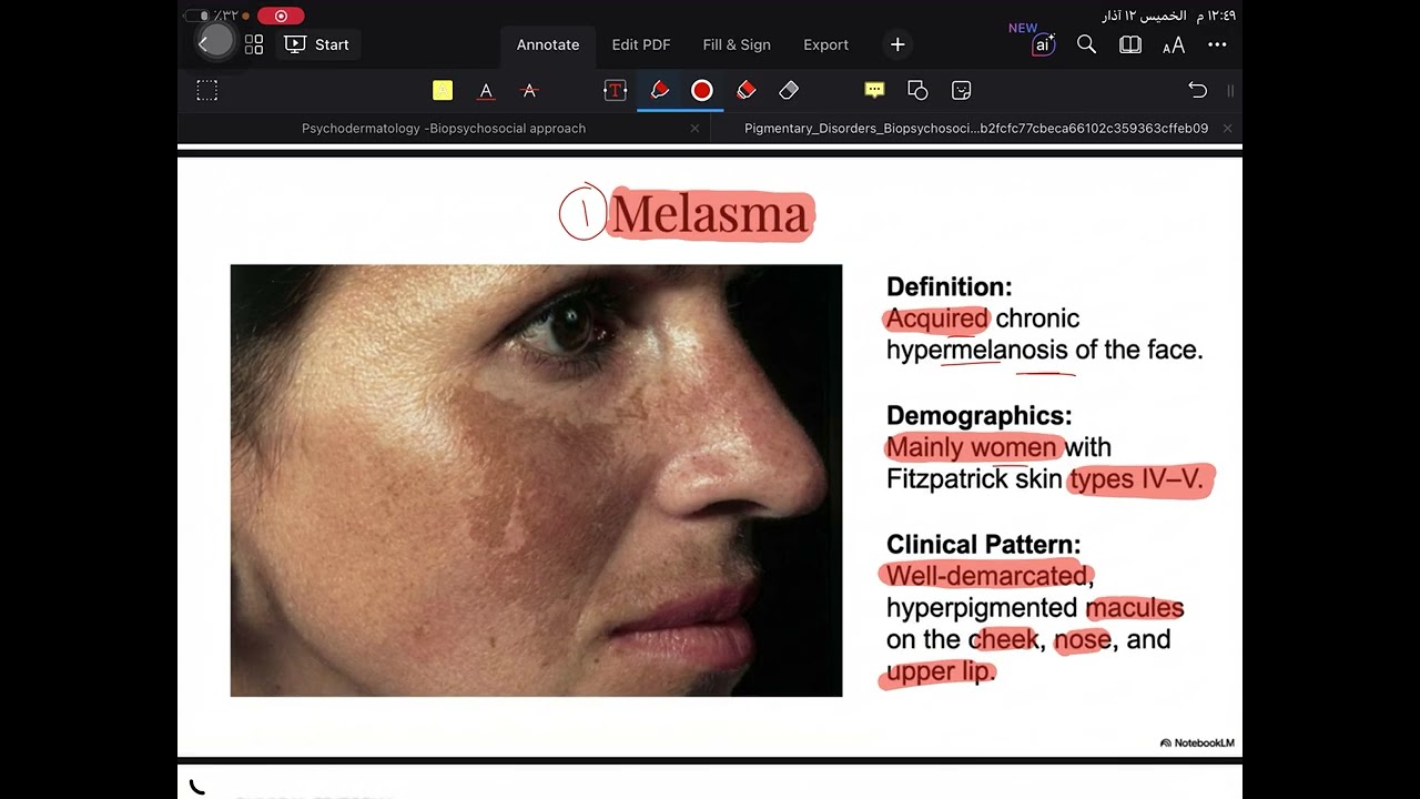 Dermatology lec 14 ( Pigment disorders)