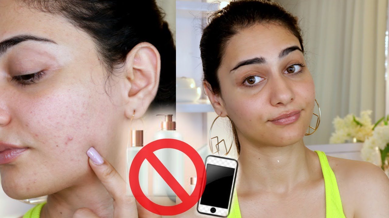 5 SKIN CARE MISTAKES EVERY GIRL MUST AVOID | SIMMY GORAYA