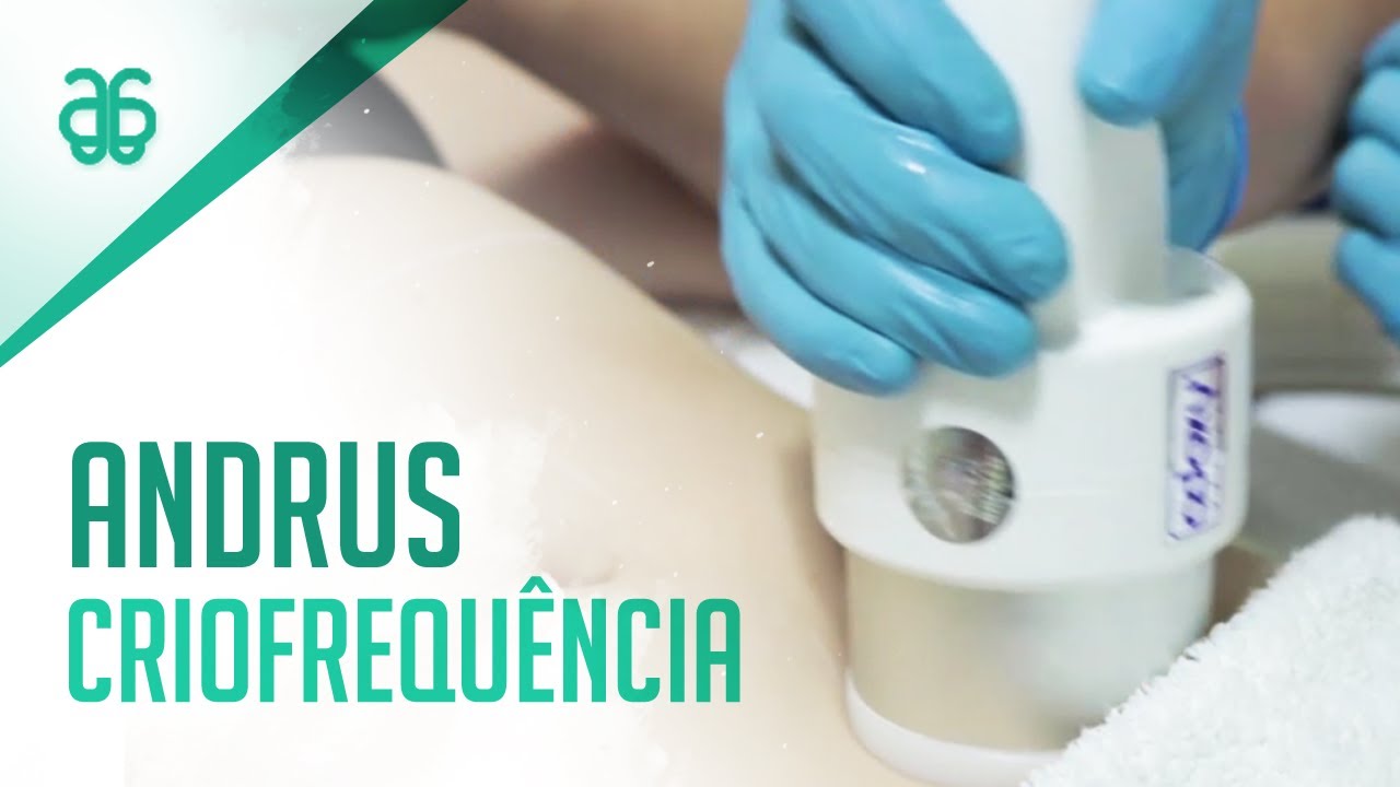 Andrus Criofrequência