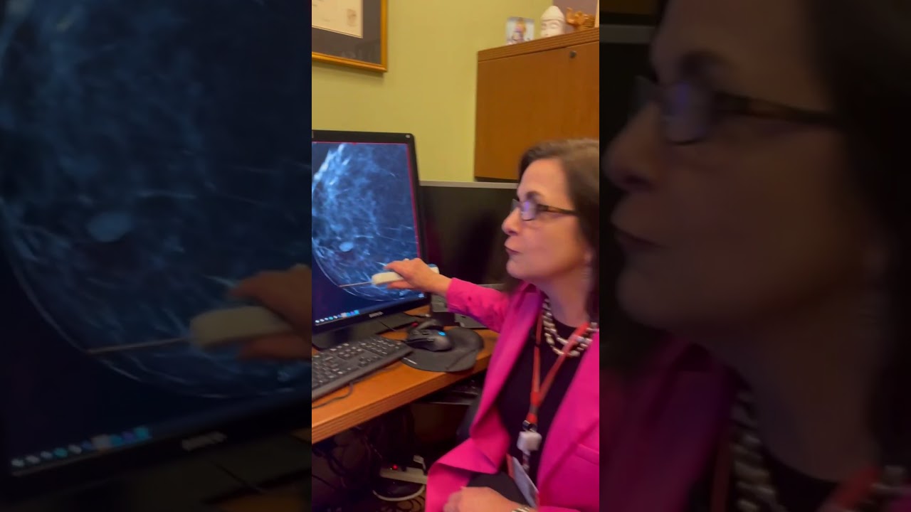What's it like to get a breast needle biopsy? 