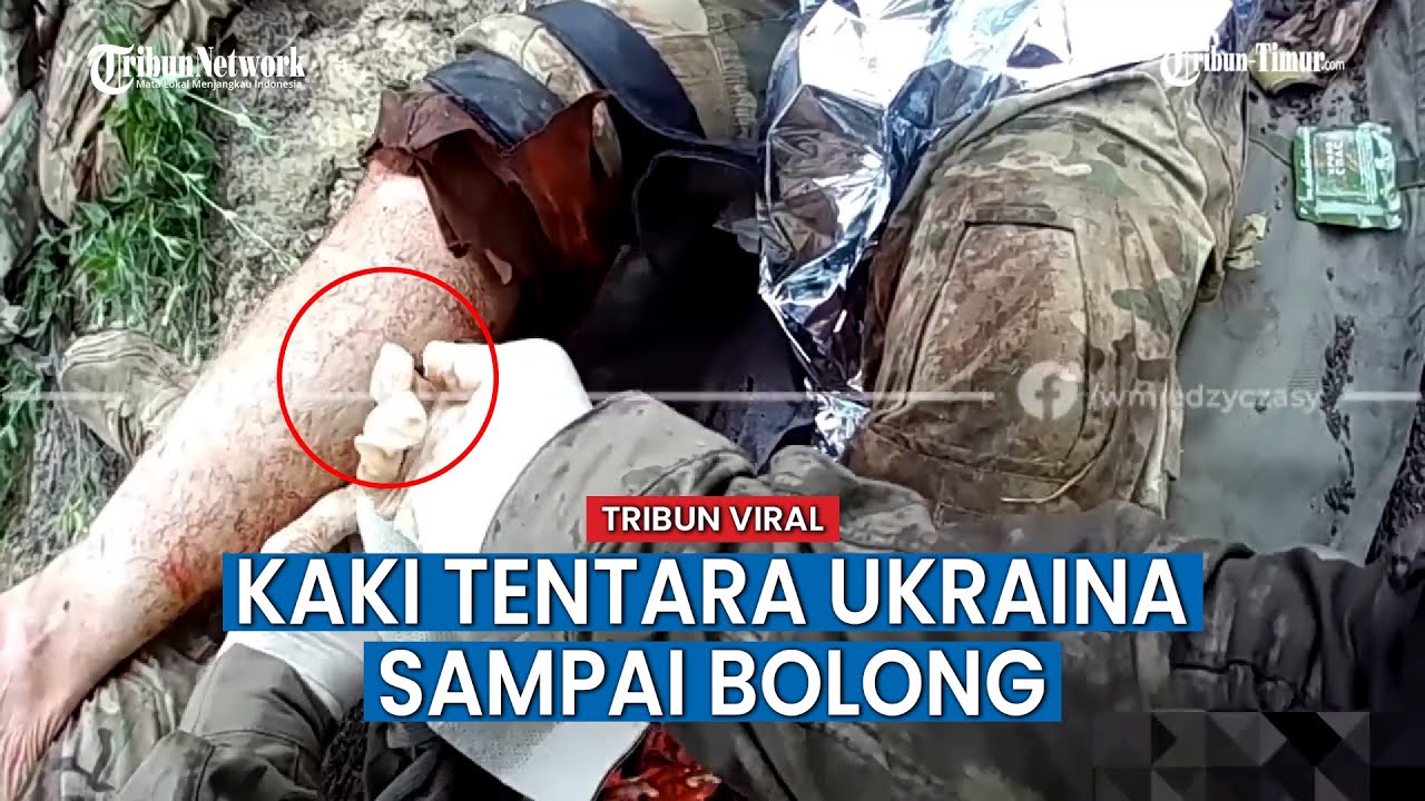 Prajurit Ukraina Kena Sambaran Amunisi Rusia, Kakinya Sampai Bolong