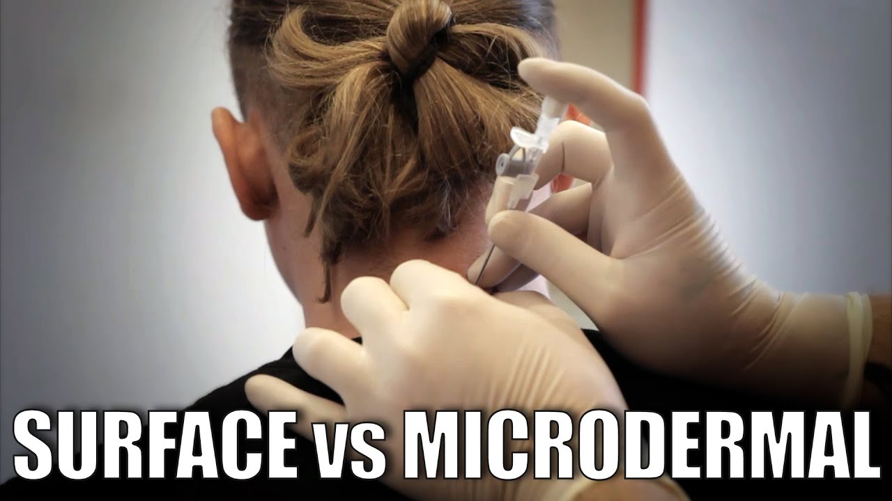 Surfacebar a microdermal piercing ✪ Bezpieczny piercing ✪