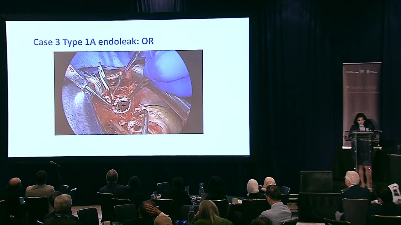 Elective aortic arch repair - Puja Kachroo