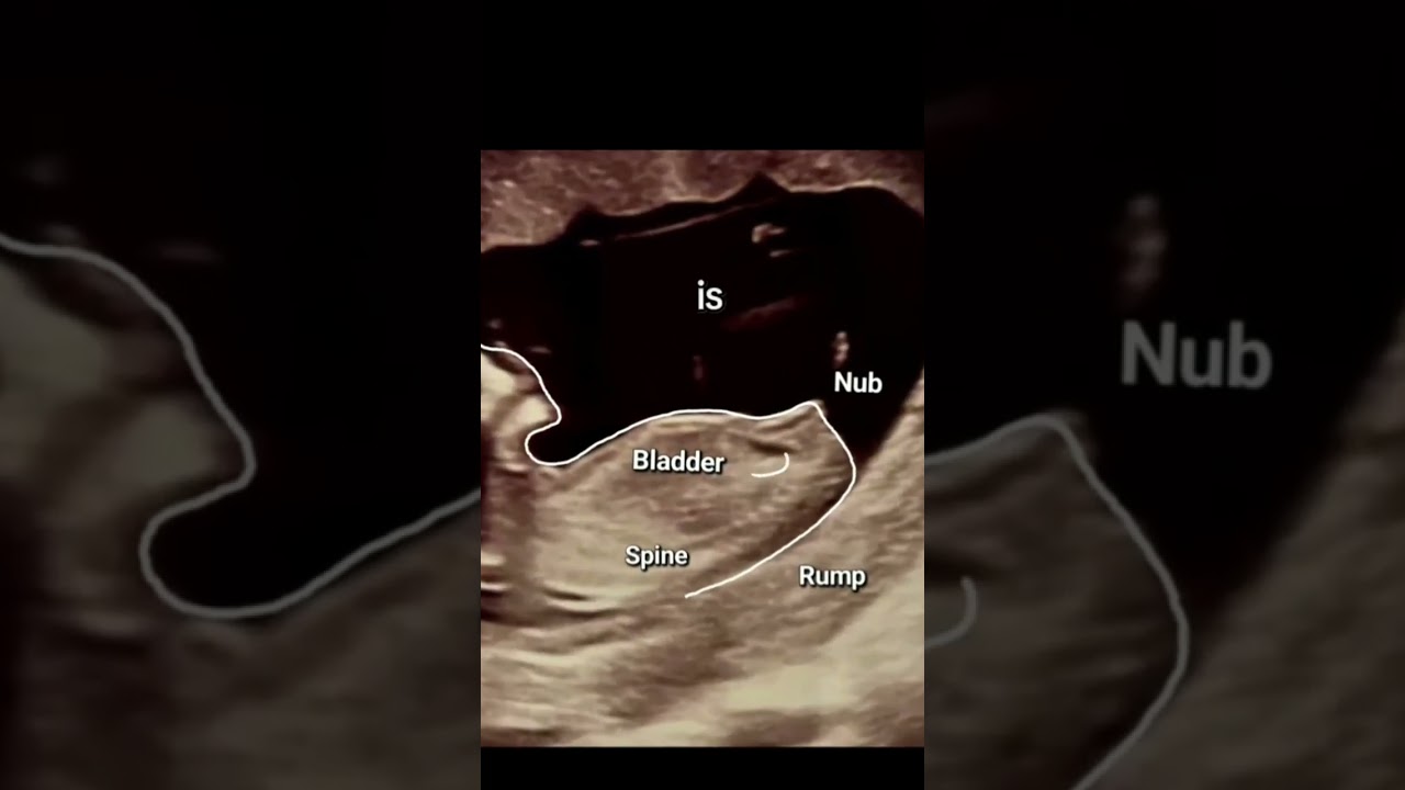 Gender reveal with Nubx!