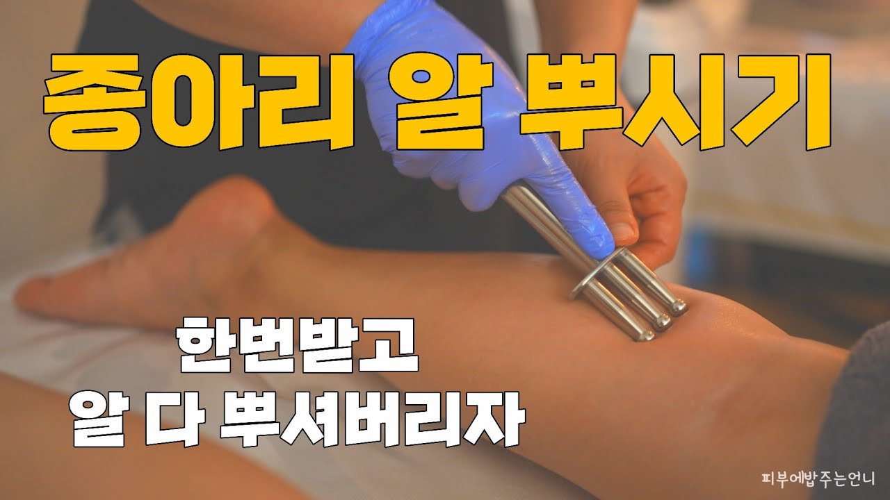 종아리 알빼기 알 뿌셔버리고 종아리 미인되자!