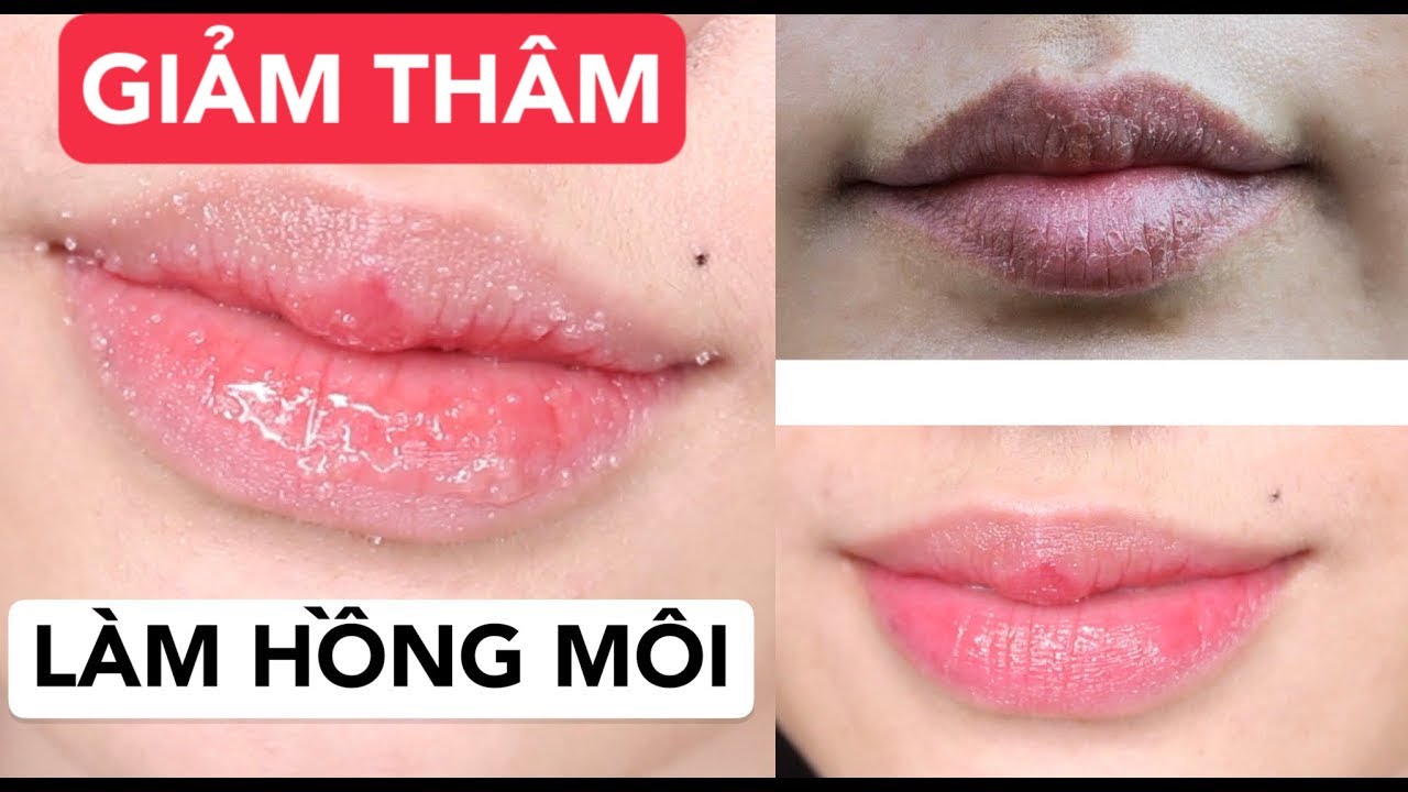 BÍ QUYẾT GIẢM THÂM MÔI, DƯỠNG MÔI HỒNG TẠI NHÀ AN TOÀN HIỆU QUẢ | Ha Linh Official