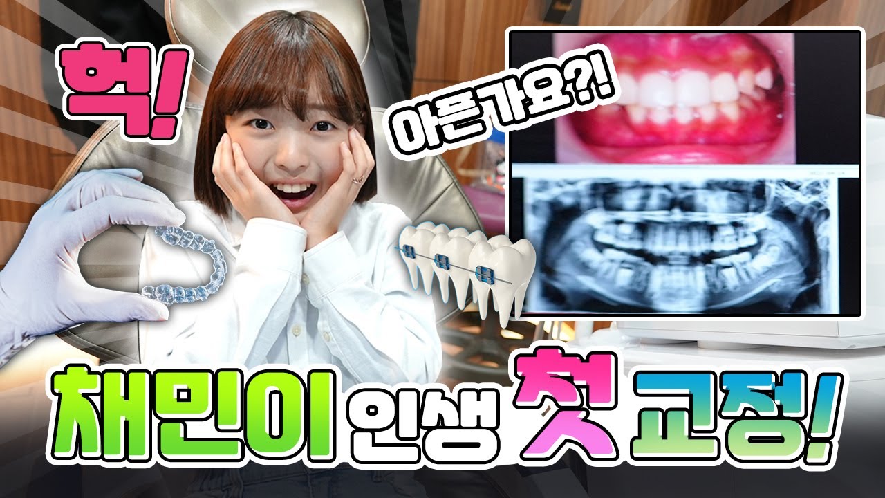 무서운 치과를 또 가게 된 채민이... 많이 아플까요?! 벌써부터 눈물이.. ㅠㅠ 채민이 치아 교정하러갑니다! 교정과정 밀착취재 브이로그｜클레버TV