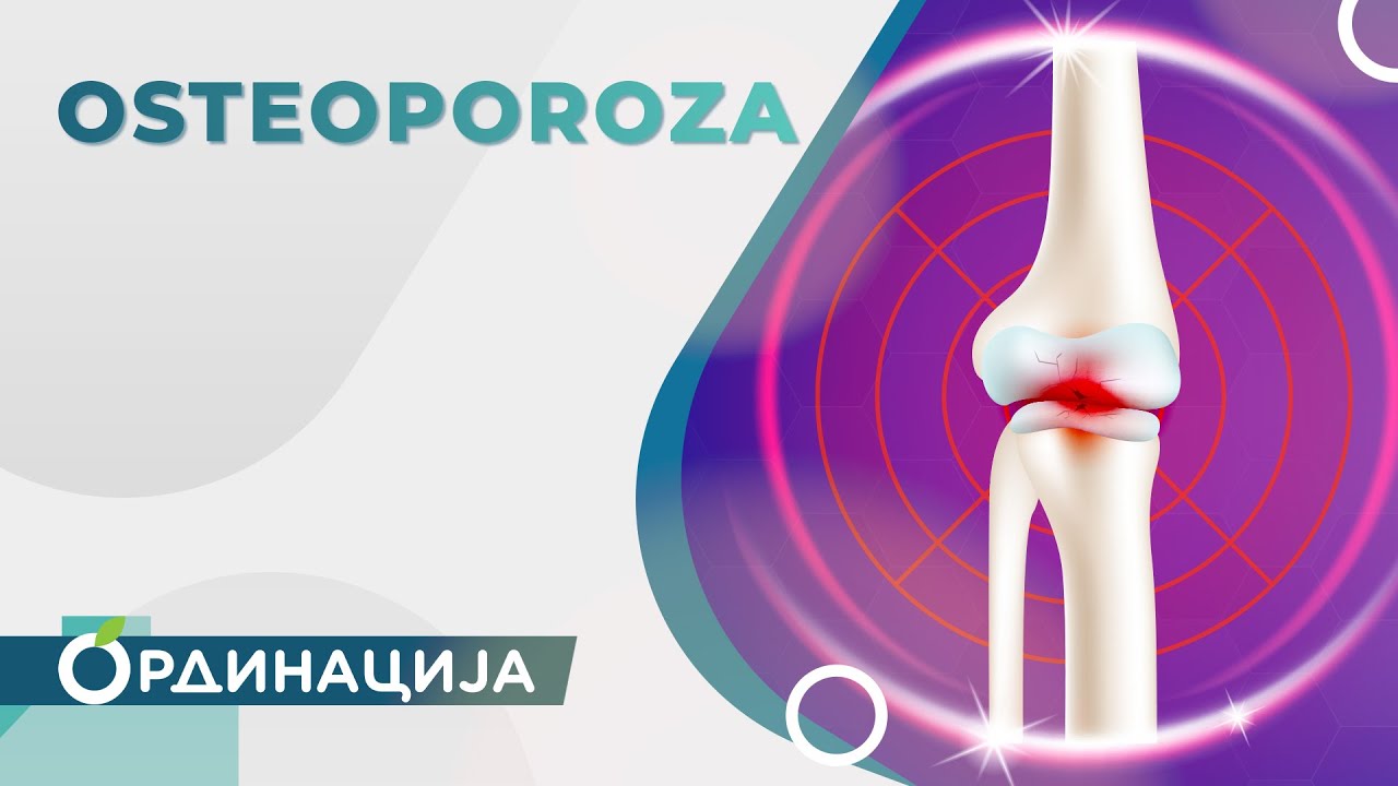 Osteoporoza | RTS Ordinacija