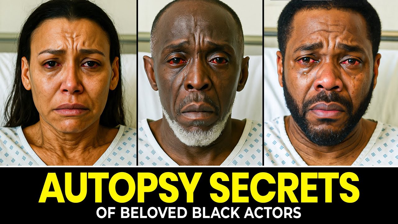16 Autopsy Revelations From Black Actor’ Deaths