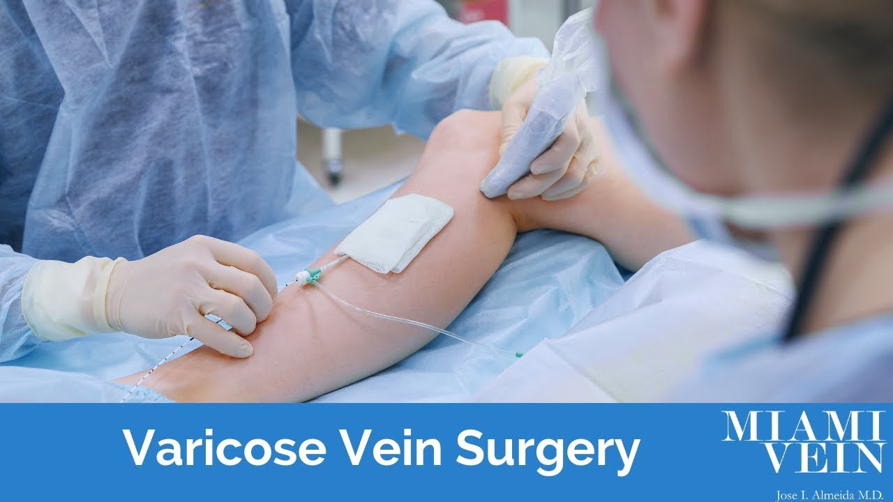 Varicose Vein Surgery Options with Dr. Jose Almeida