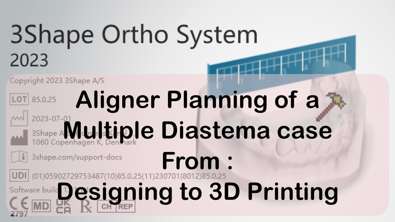 Step-by-Step Aligner Planning for Spacing Cases Using 3Shape Ortho Studio: From Design to 3D Print