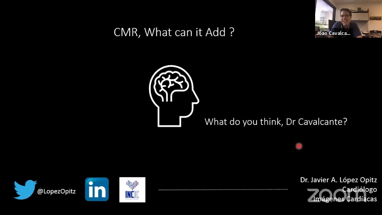 Cardiac MRI for Mitral Regurgitation – What can it Add, Dr. Joao Cavalcante