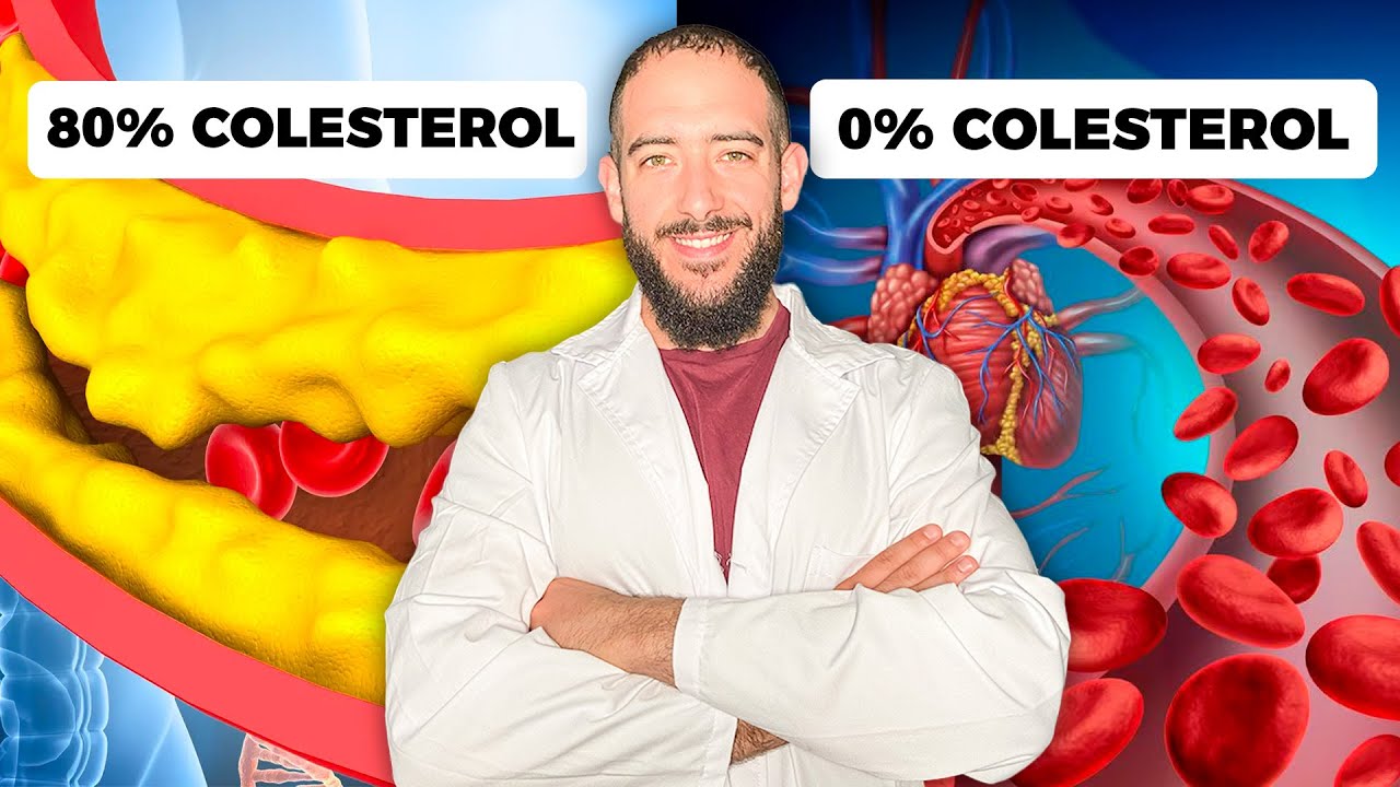 Arterias Limpias de Colesterol sin Tomar Estatinas: 3 H&aacute;bitos Sencillos