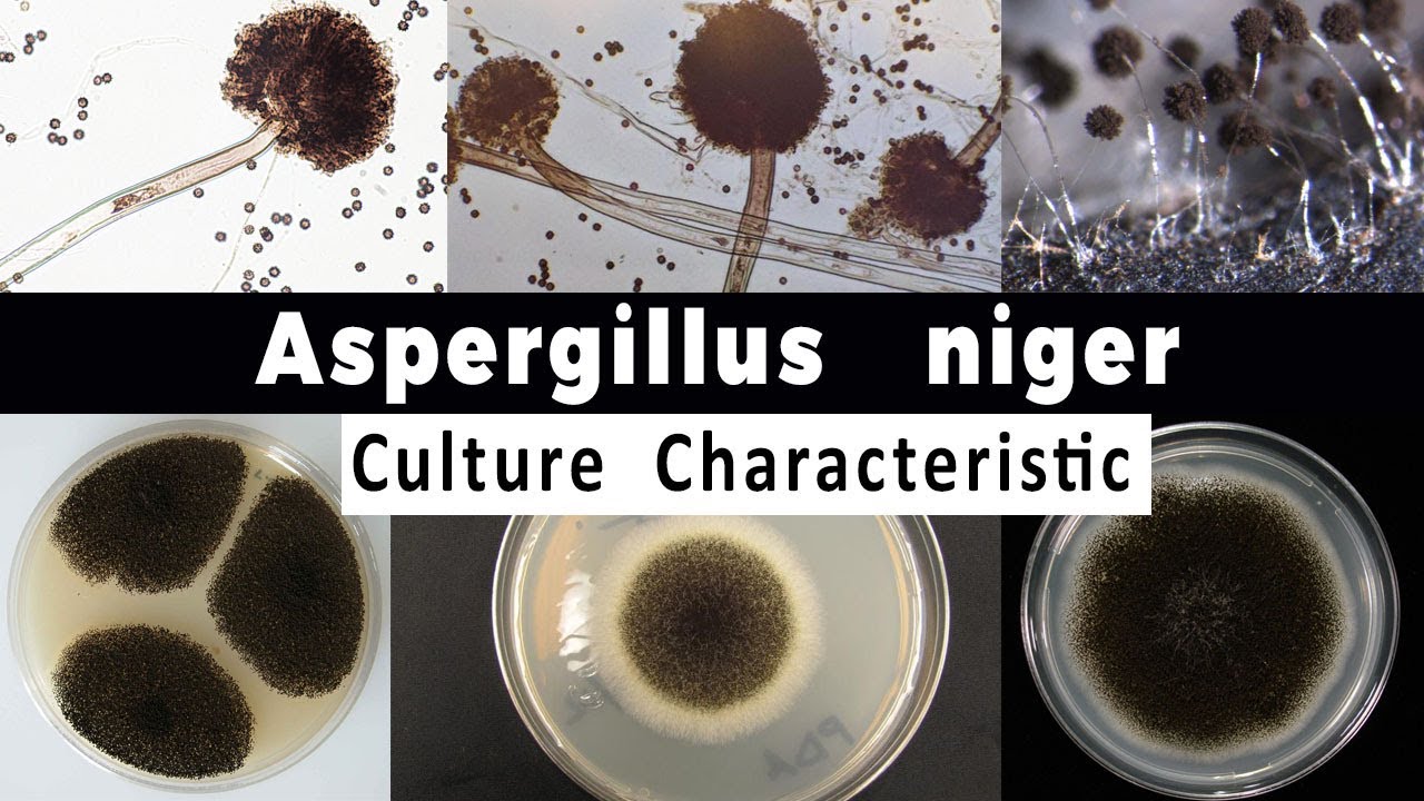 Aspergillus niger Culture Characteristic