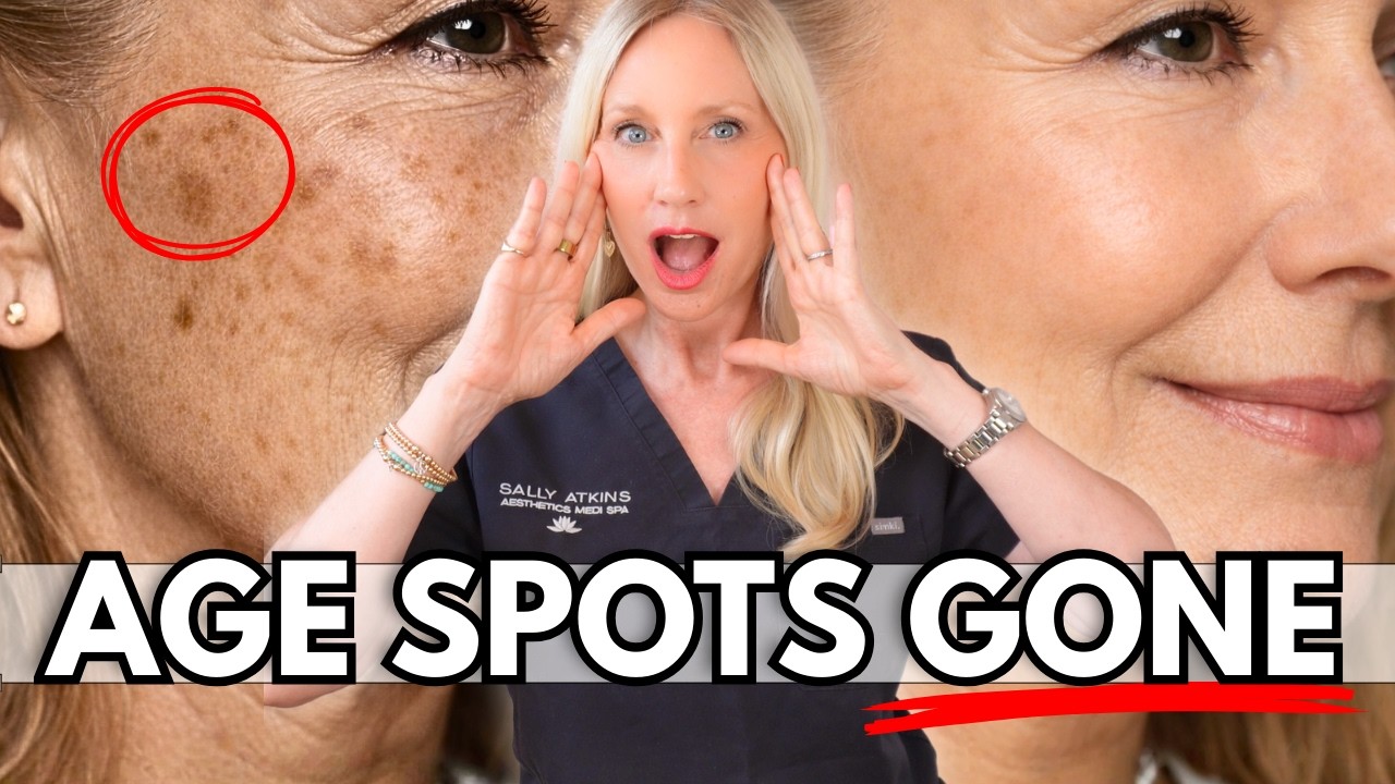 AGE SPOTS After 50? THIS WORKS #1 Treatment for Women Over 50