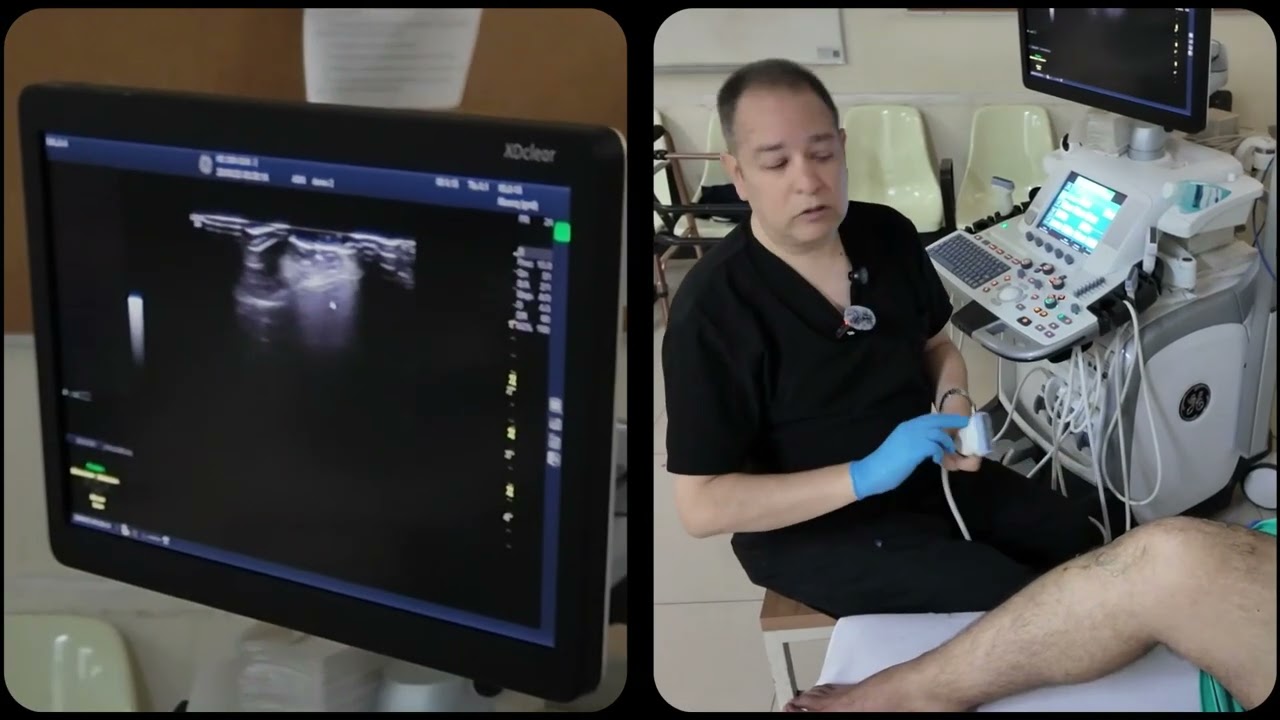 5-13 Demo Ultrasonido de Rodilla | Dr. Ornelas