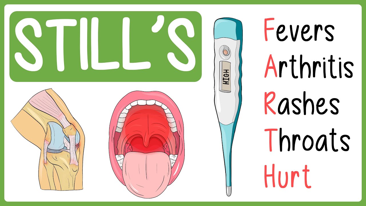 Adult-Onset Still’s Disease Visually Explained