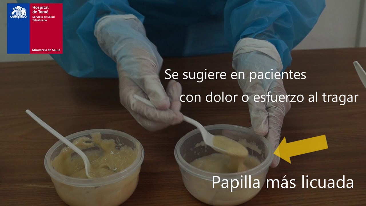 Consistencia de la alimentación en pacientes con disfagia o dificultad al tragar.