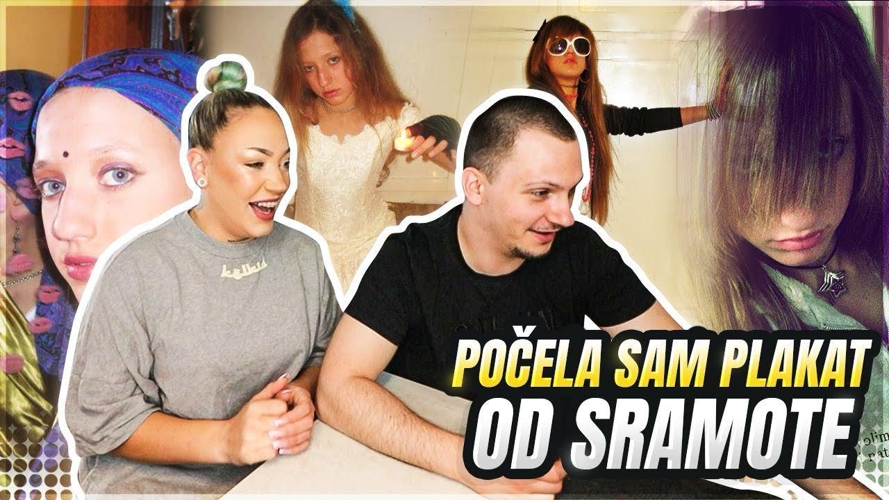 MOJE LICE PRIJE SVIH OPERACIJA!!! *STRA&Scaron;NO* W.ALEX