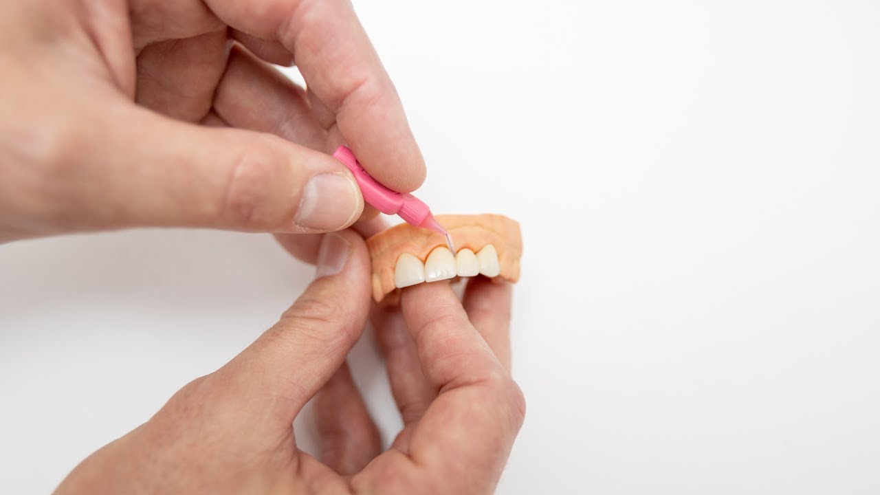 How To Clean Under A Bridge with floss or interdental brushes  - Amelo