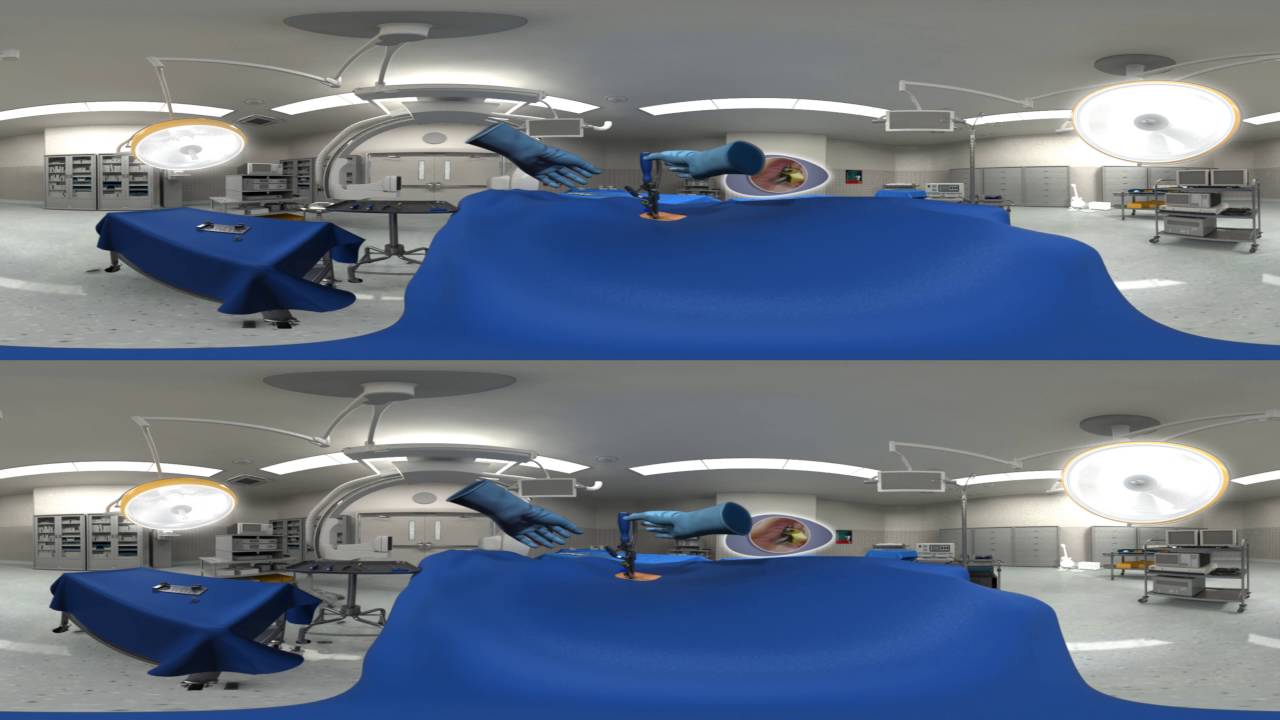 InterBRIDGE – 360° 3D Full Surgical Technique Animation
