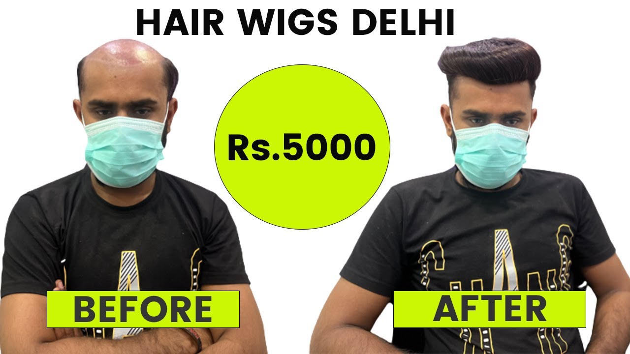 Hair Wigs in Delhi | Hair Patch in Delhi | Hair Fixing in Delhi | Hair Wig Service in Delhi