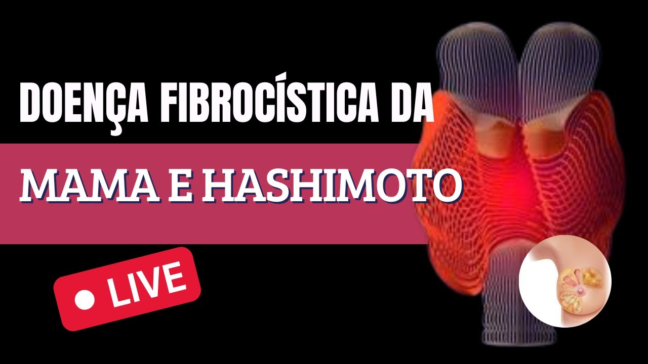 Doença fibrocística da mama e Hashimoto - Dr. Rogério Leite