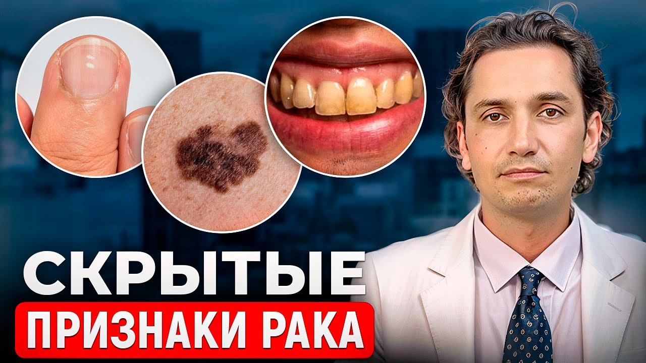 Скрытые признаки РАКА! НЕ ИГНОРИРУЙ ЭТИ СИГНАЛЫ!