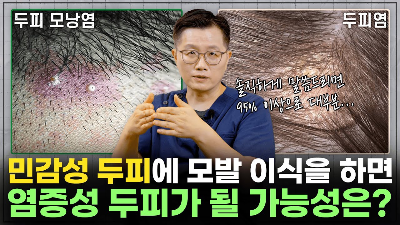 두피 발적과 지저분한 분비물...모발 이식을 해도 괜찮을까?_[모발이식, 탈모 해결사]