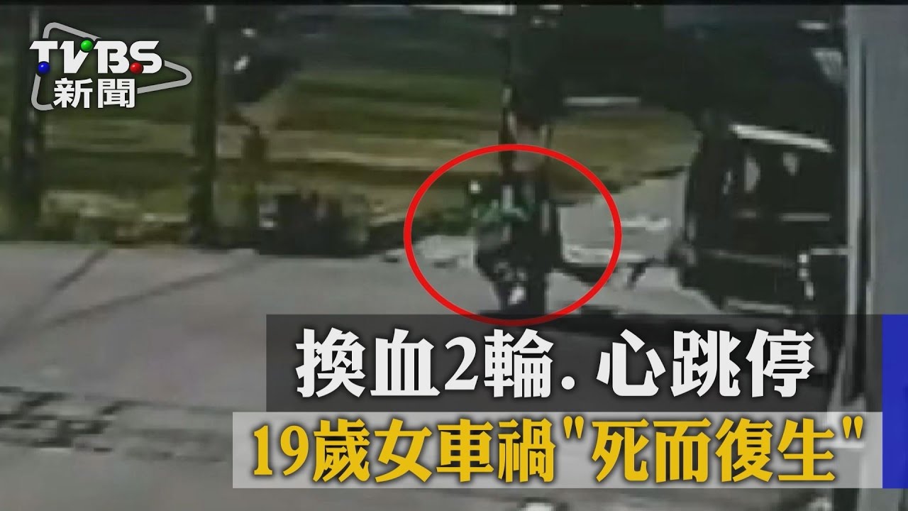 【TVBS】換血２輪、心跳停　１９歲女車禍「死而復生」