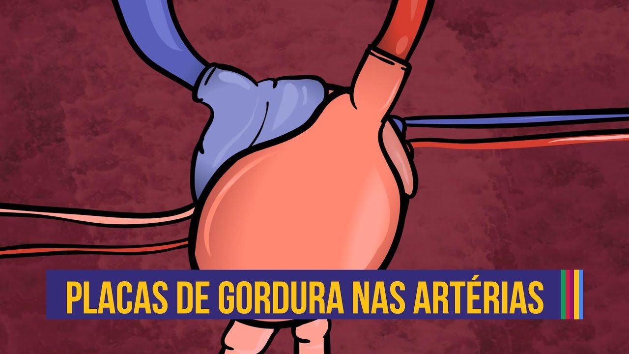Como se formam as placas de gordura | Anima&ccedil;&atilde;o #08