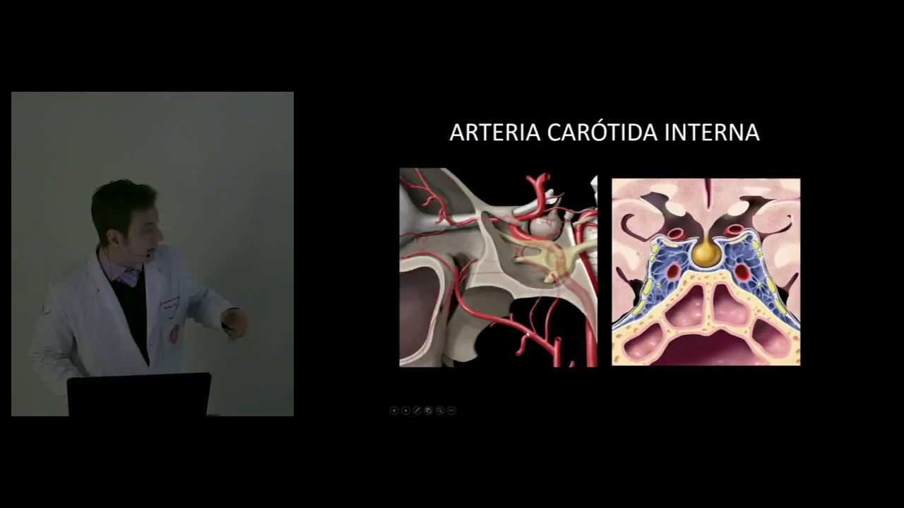 Anatomía vascular arterial intracraneal. Dr. Claudio Casas