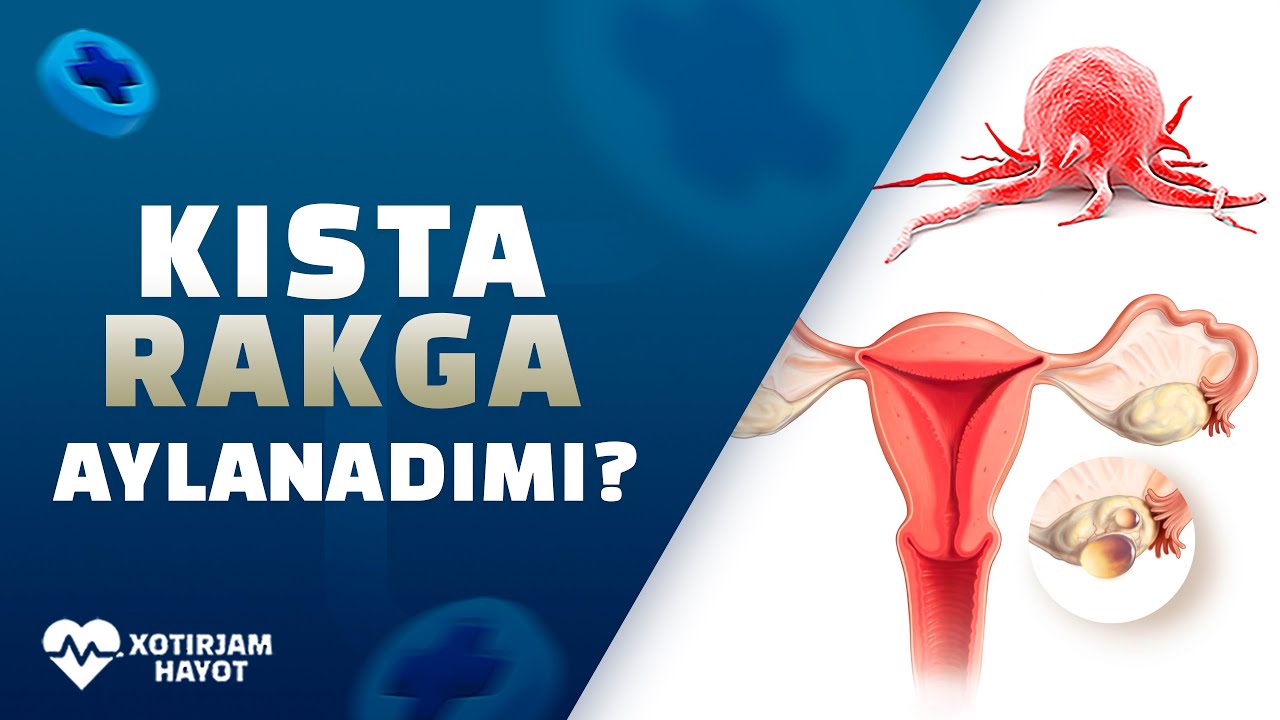 BACHADON VA TUXUMDON KISTALARI RAKGA AYLANADIMI?
