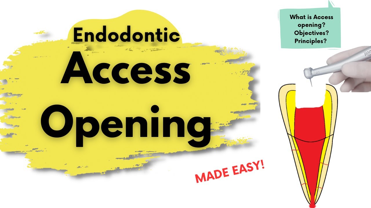 Access Preparation I What is it? I Principles and Objectives I Endodontics