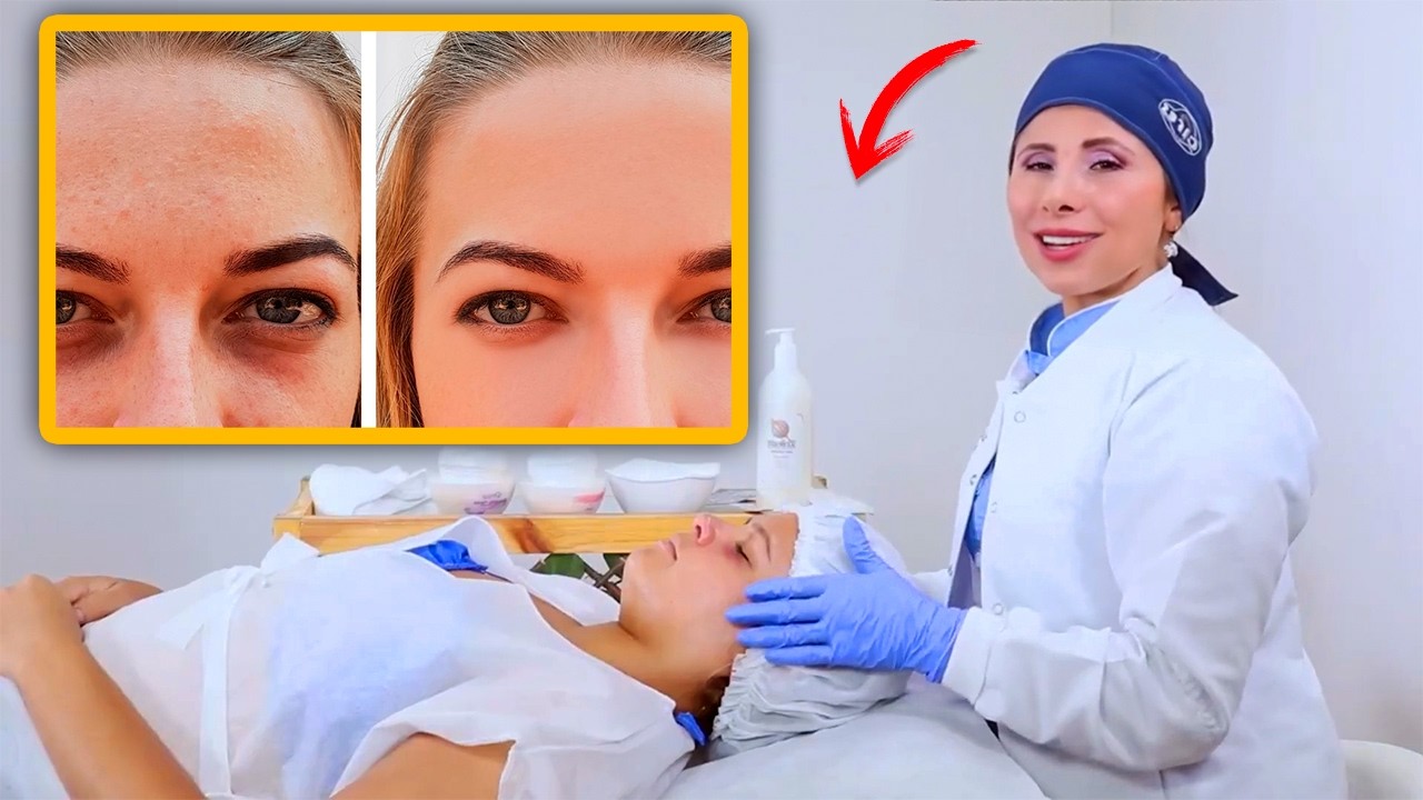 ✨Cómo Eliminar Ojeras Rápido con Drenaje Linfático | Técnica Efectiva