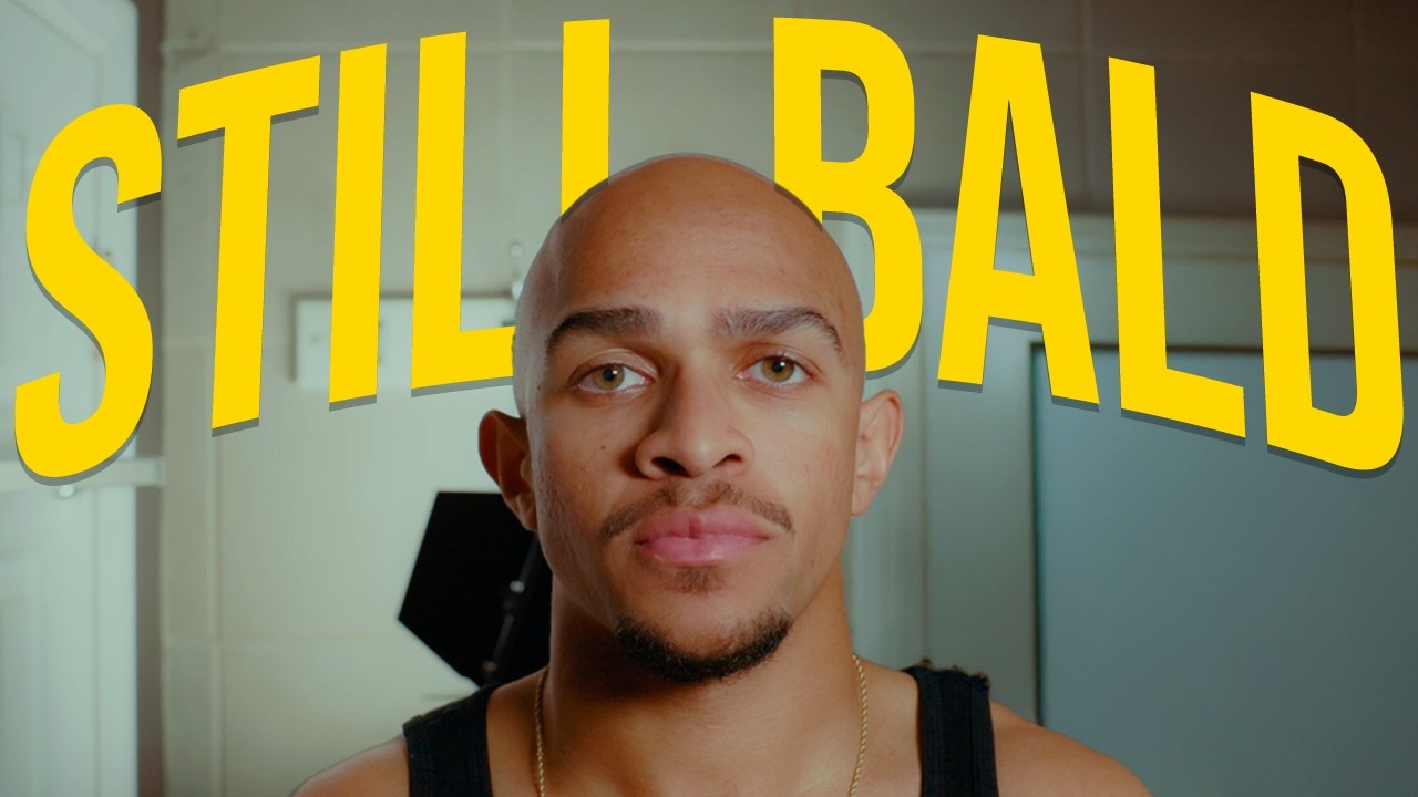 I'm 24 and i'm still bald.