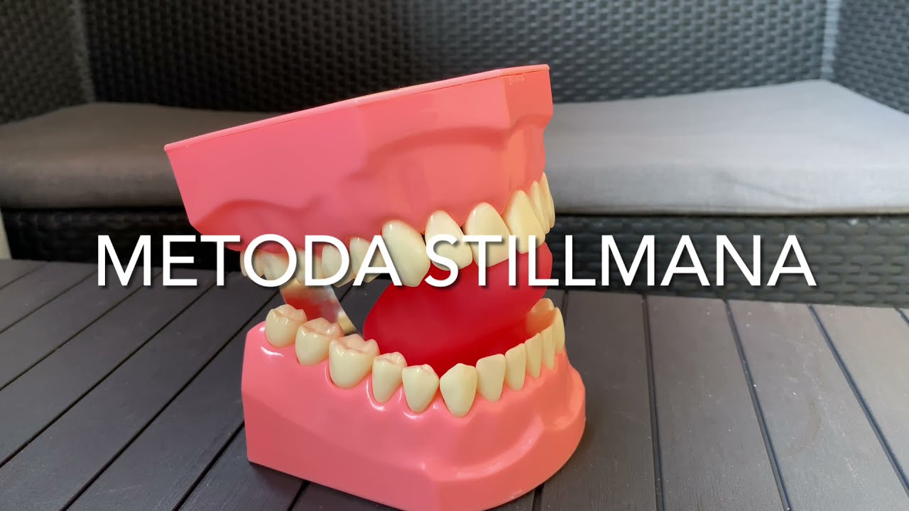 Metody szczotkowania. Metoda Stillmana.
