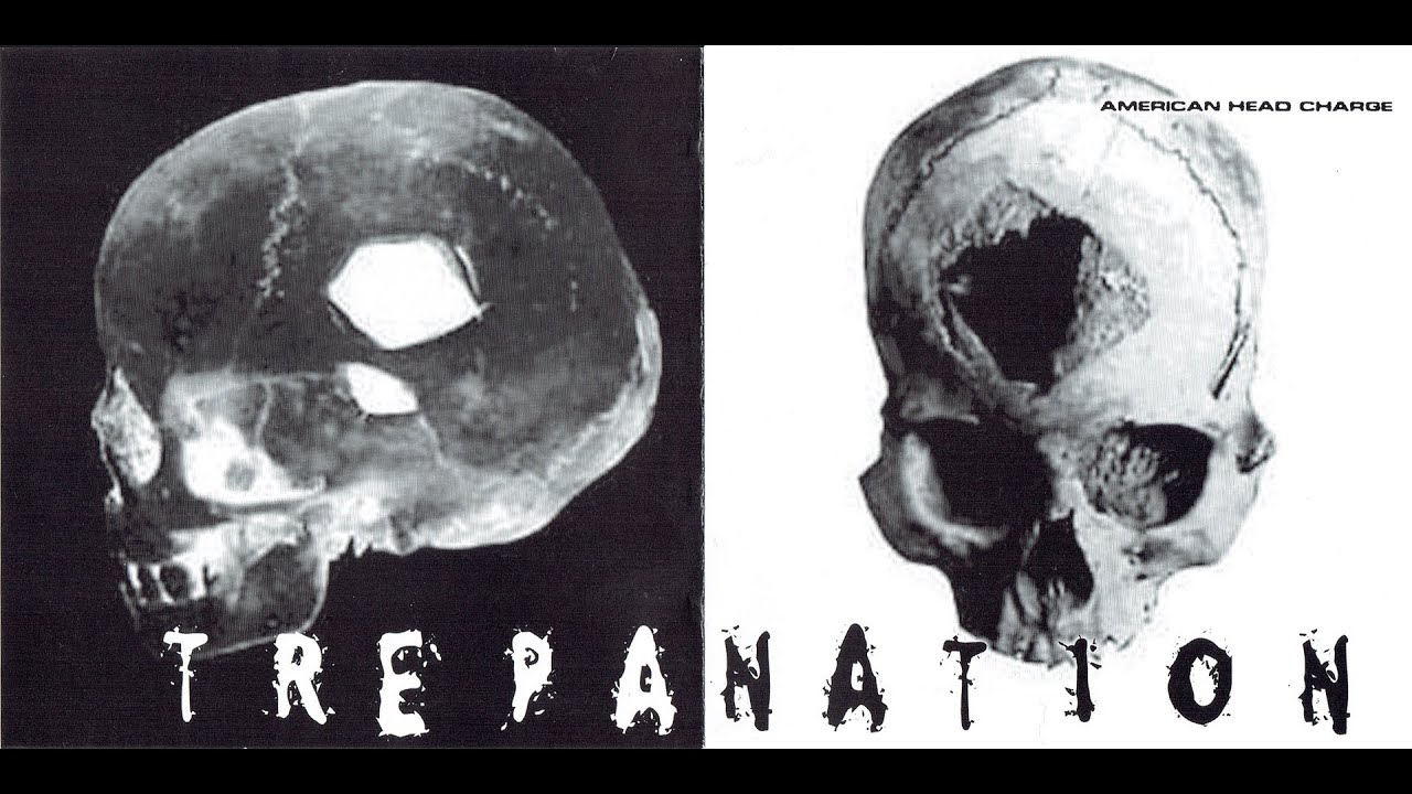 American Head Charge - What (Trepanation)