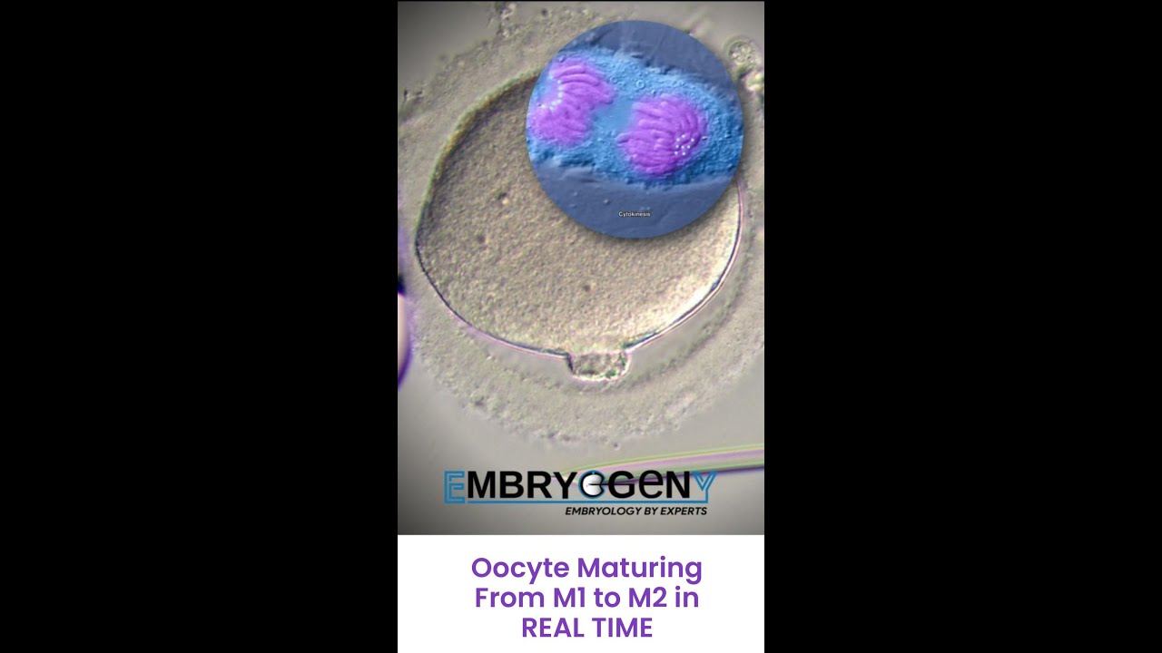 Oocyte Maturation from M1 to M2 in Real Time - Watch the Molecular Masterpiece Under Microscope