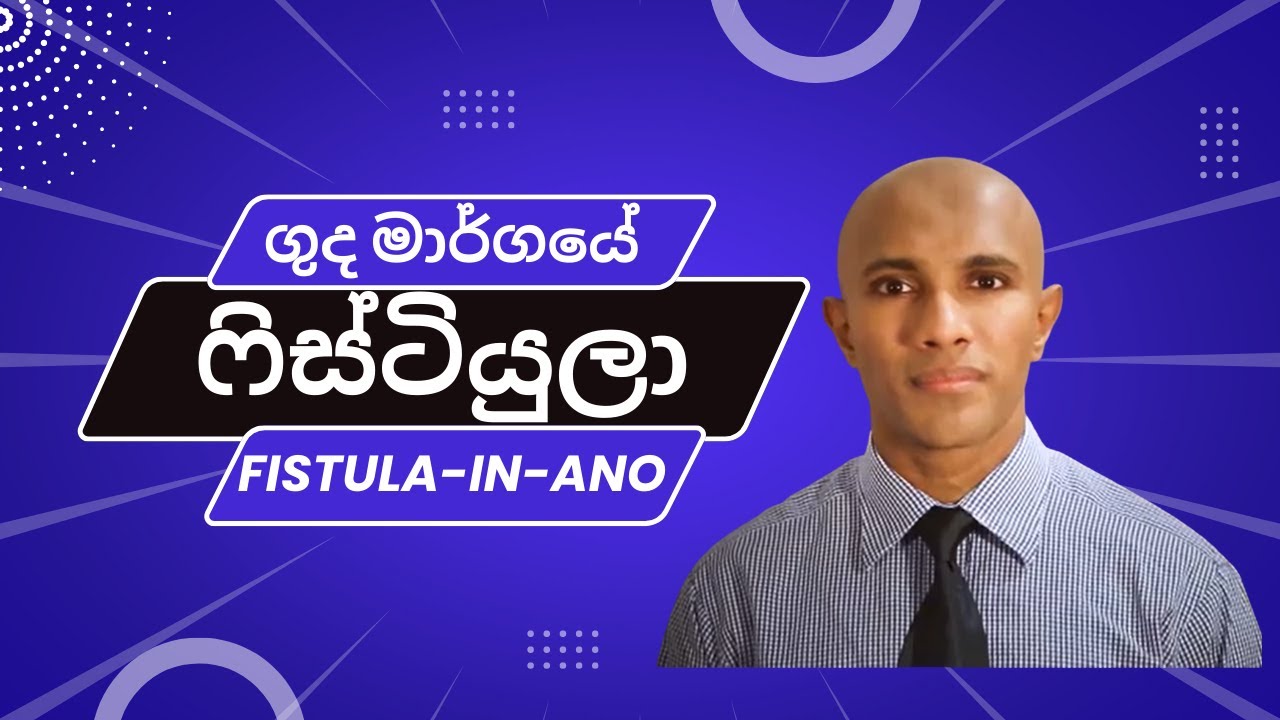 ගුද මාර්ගයේ ෆිස්ටියුලා (බගන්දරා/Fistula-in-ano) - මහාචාර්ය  දක්ෂිත වික්‍රමසිංහ