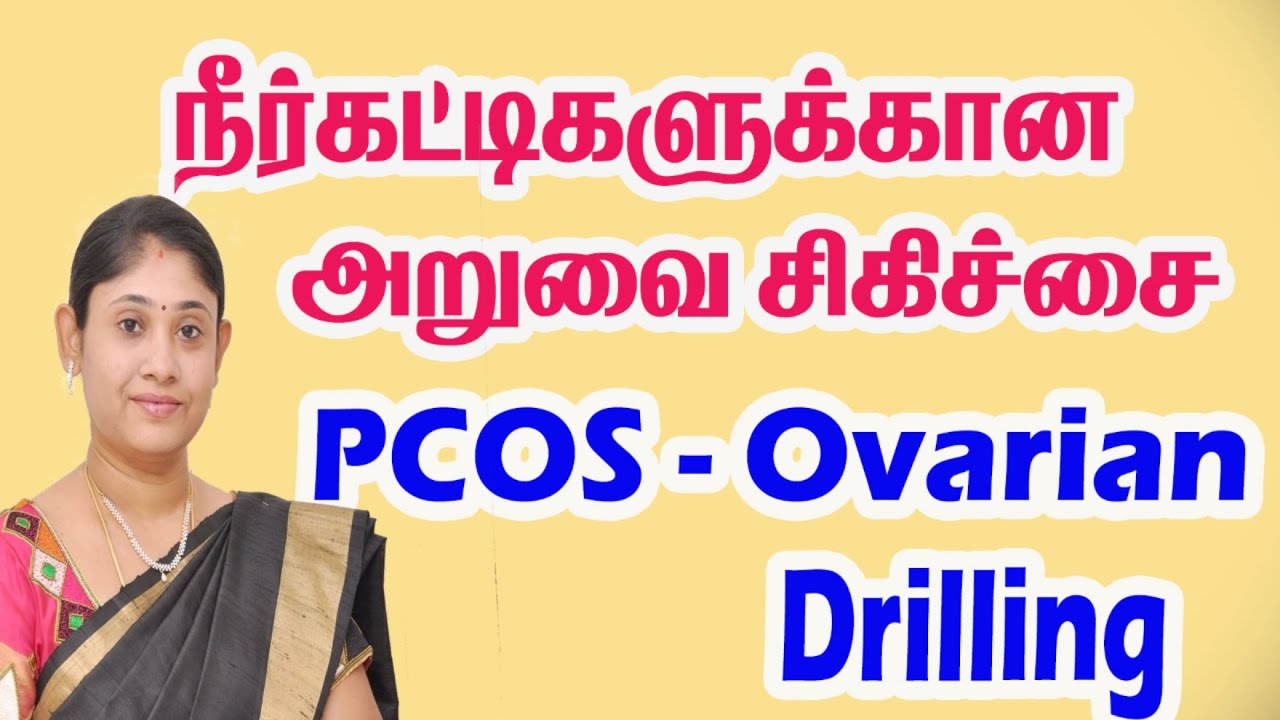 PCOS நீர்கட்டிகளுக்கான அறுவைசிகிச்சை  PCOS Ovarian Drilling How To Get Pregnant with PCOS in Tamil