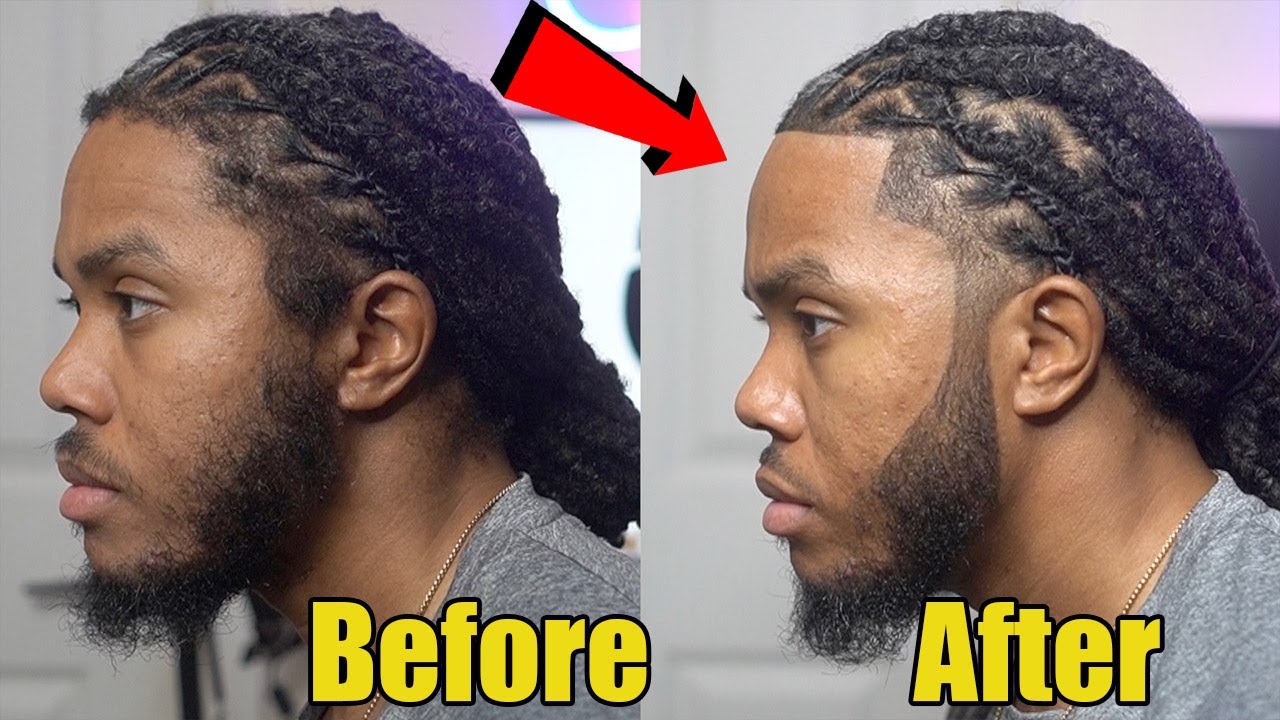 How to Save Your HAIRLINE with Dreadlocks | BE CAREFUL!!!